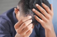 Een nieuwe look: alles over haartransplantaties